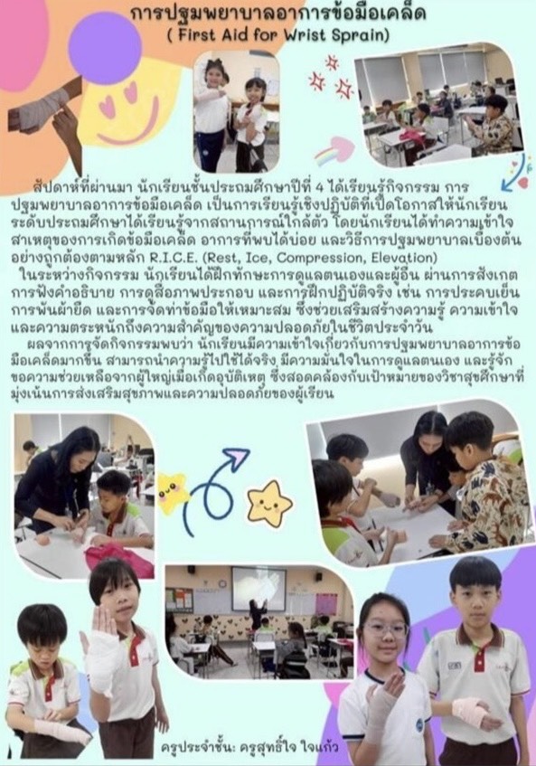 การปฐมพยาบาลอาการข้อมือเคล็ด ( First Aid for Wrist Sprain)